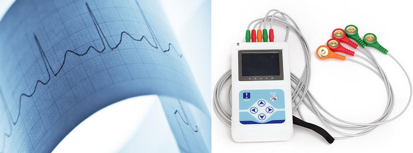 ECG Holter bekaa lebanon